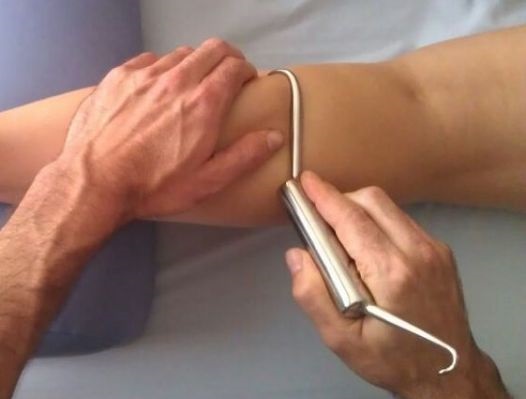 ganchos para Fibrólisis dicutánea