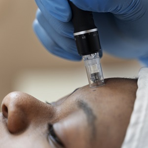 dermapen